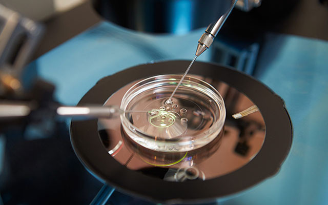 Draft laws on ART need further refinement — UNBA